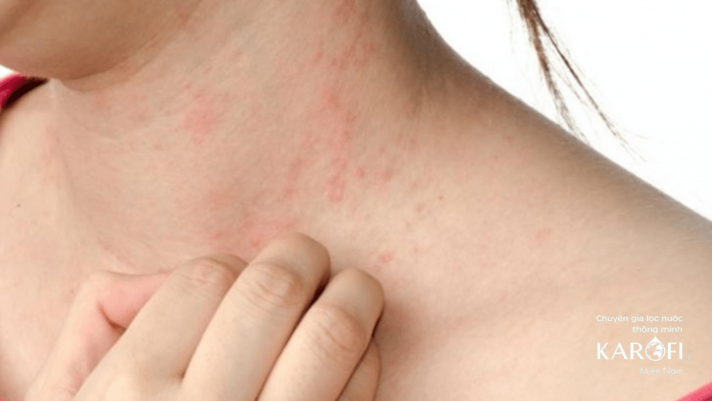 Tác hại khó lường khi sử dụng lõi lọc kém chất lượng